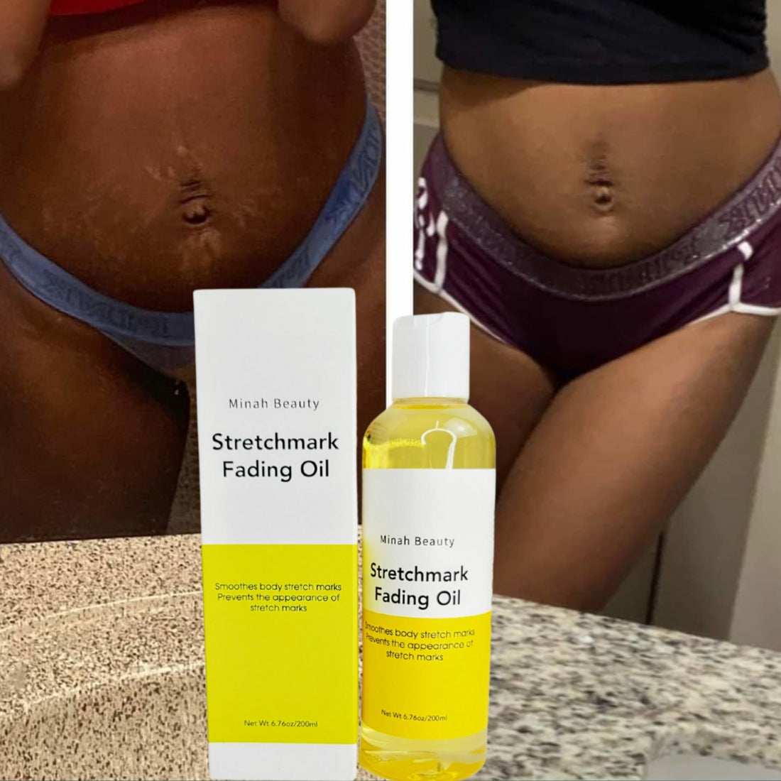 Stretch mark fading oil